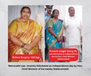 Before and after of bariatric surgery