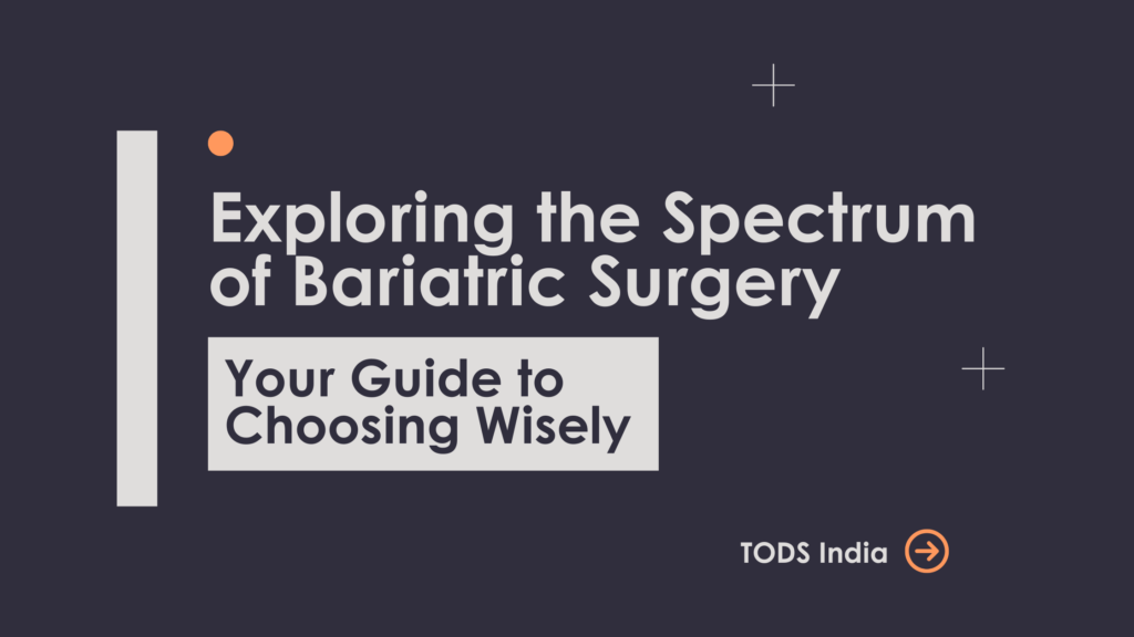Bariatric Surgery