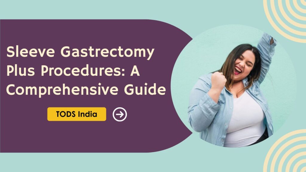Sleeve Gastrectomy