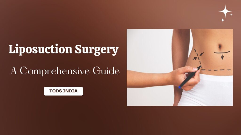 Liposuction Surgery