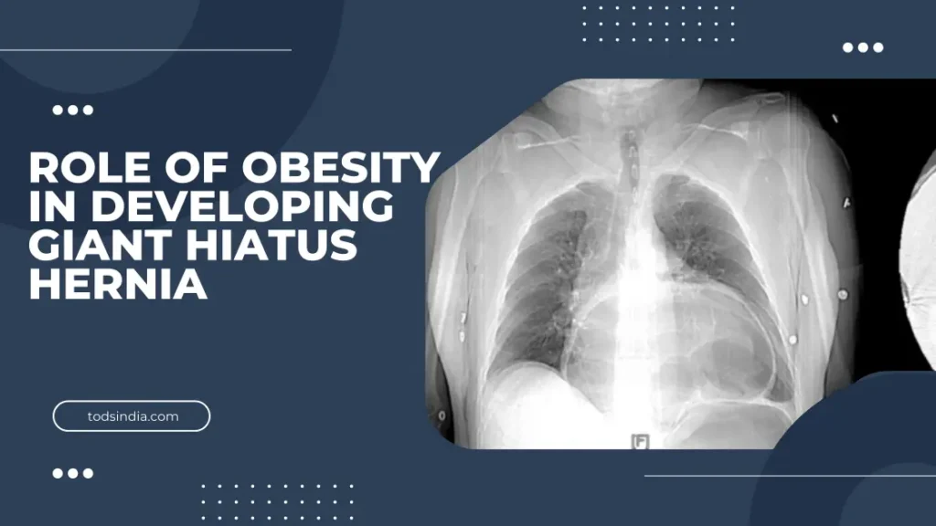 Giant Hiatus Hernia